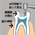 ●切れ味の落ちたバーは使わない！