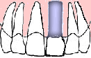 ＥＸ．１ 