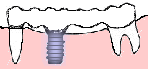 ＥＸ．２ 